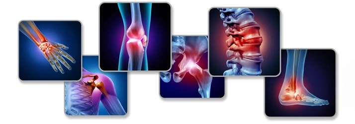 Collage of medical illustrations showing joint pain in various areas of the body
